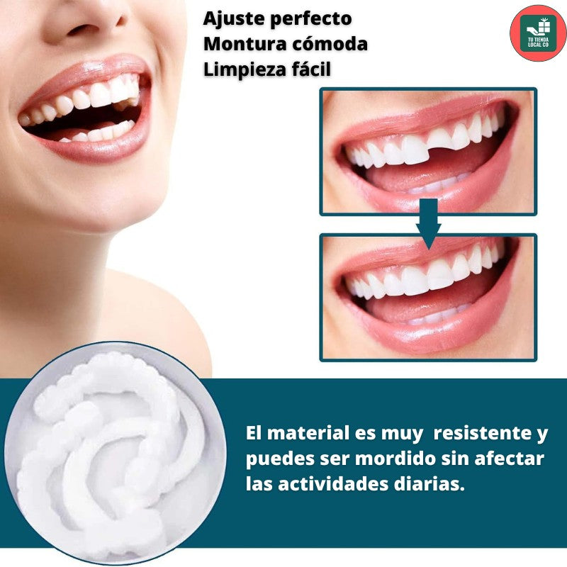 Compra 1 y llévate 2 - Carillas Dentales ! 40% OFF SOLO HOY